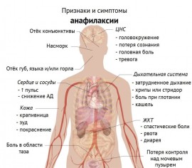 Анафилаксия: особенности заболевания и лечение