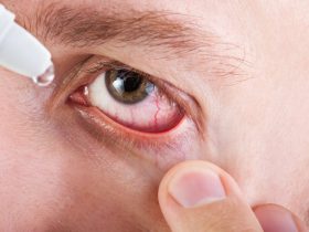 Красные глаза при аллергии 