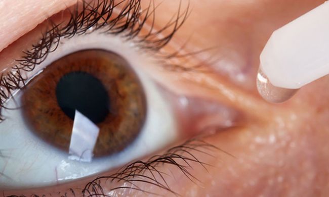Слизистая оболочка глаза обладает сверхчувствительностью к бытовой пыли, плесени, цветочной пыльце, шерсти и другим раздражителям